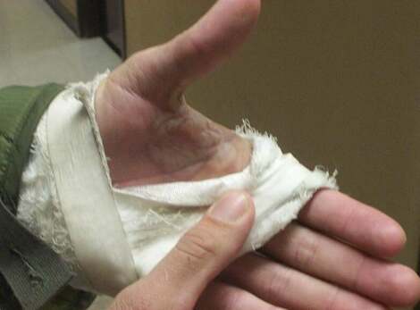 It's not good to grab something that's over 800 Degrees F